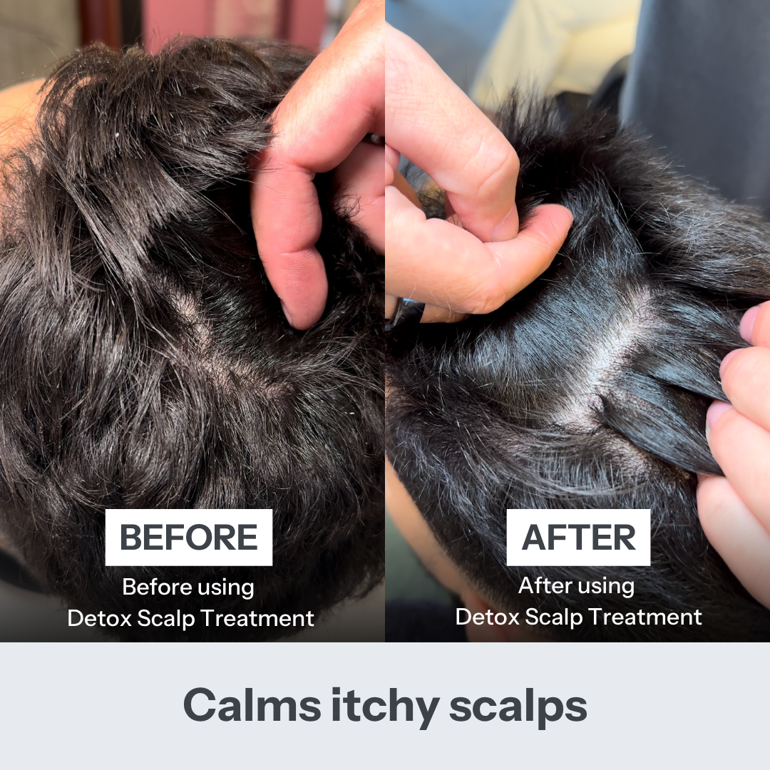 FUL Detox Scalp Treatment 150ml– Relief for Dry, Flaky or Itchy Scalps | Clarifying & Hydrating